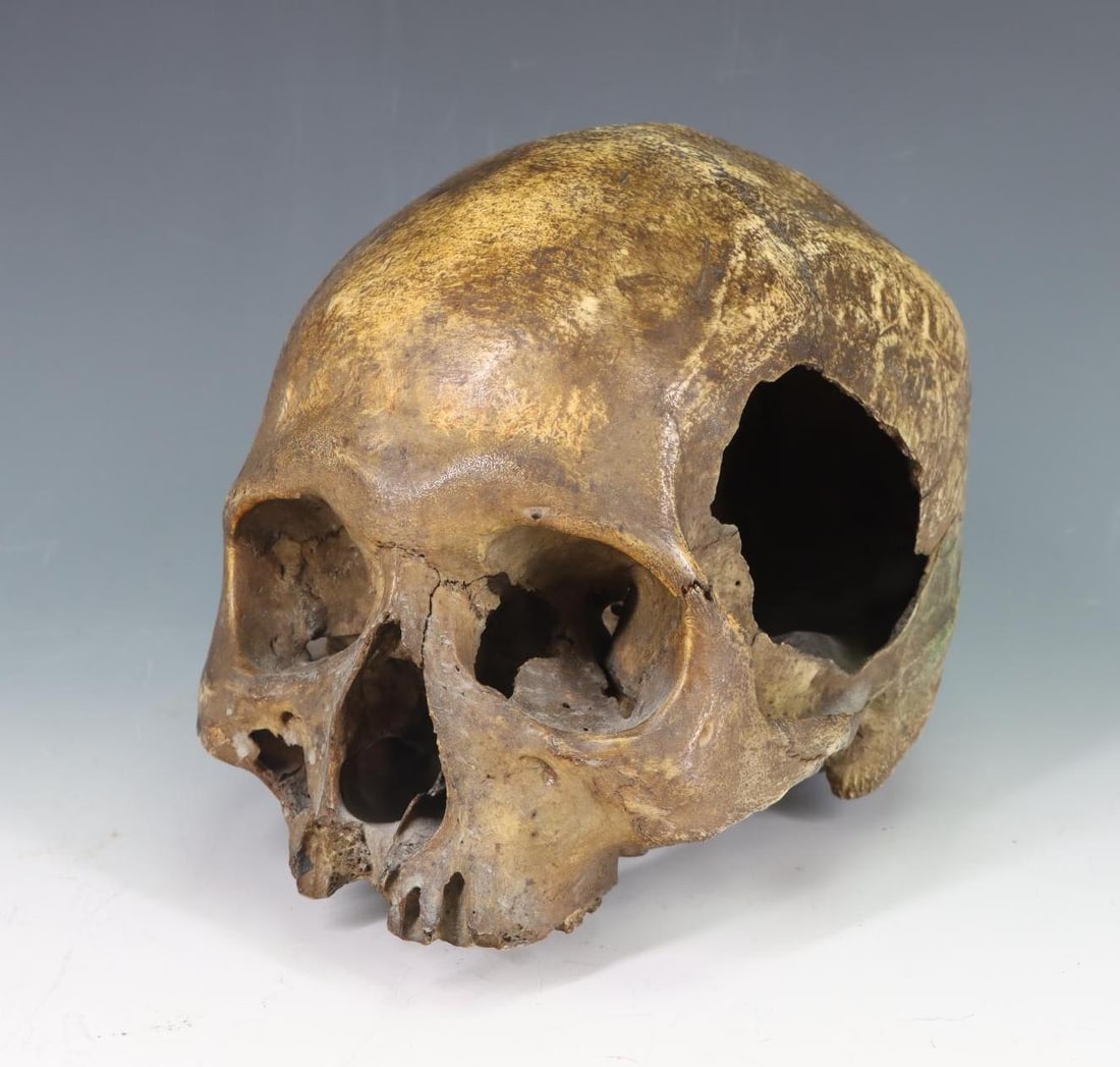 Human Skull Medical Specimen (1 of 8)