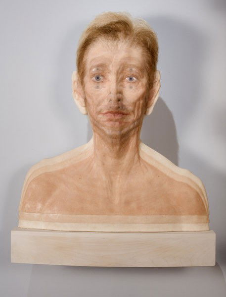 Evan Penny (Canadian, b. 1953) Triple Exposed View: Evan Penny (Canadian, b. 1953) Triple Exposed View, 2003; Silicone, pigment and hair on wood support; 31'' x 25'' x 2 1/2''; Provenance: Trepanier Baer Gallery, Calgary; Private Collection