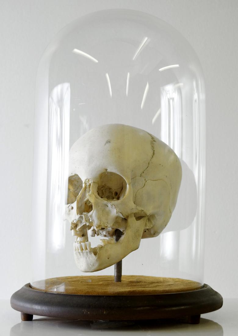 HUMAN CHILD'S SKULL FOR MEDICAL STUDY IN VICTORIAN (1 of 6)