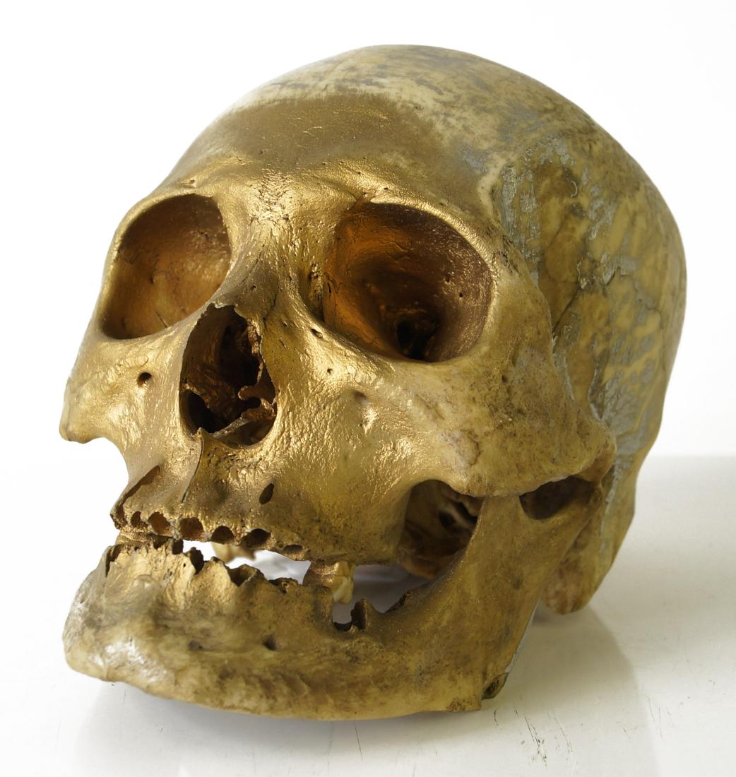 HUMAN SKULL FOR MEDICAL STUDY (1 of 5)