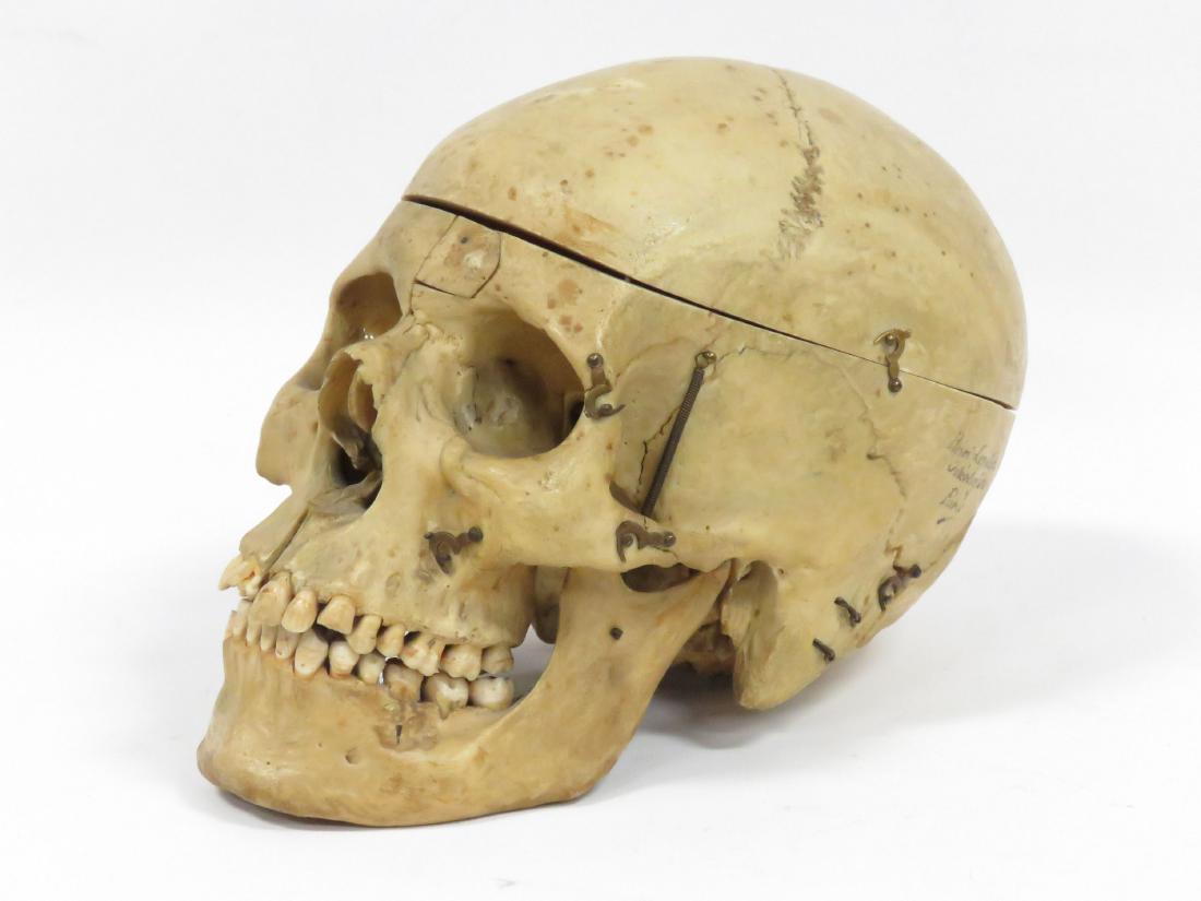 HUMAN MEDICAL SCHOOL SKULL, SIGNED HENRI LAVALETTE, (1 of 5)