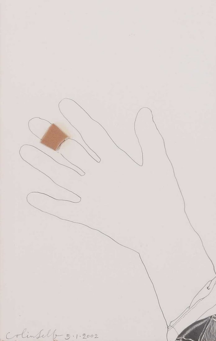 ▲ Colin Self (British, b.1941) Hand with plaster (1 of 4)