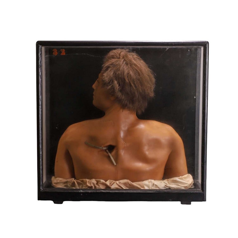 A medical diorama, early to mid-20th century, (1 of 3)