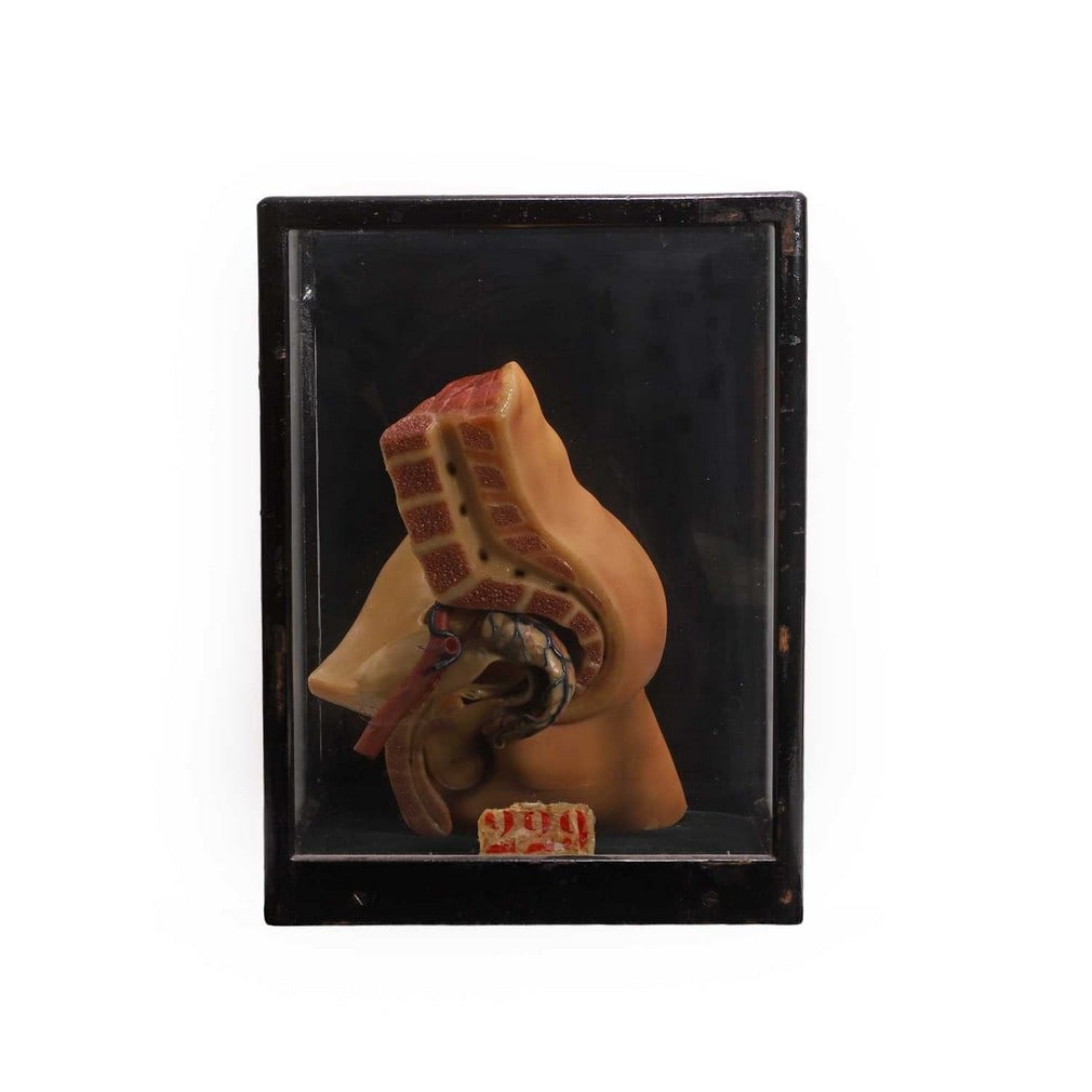 A medical diorama, early 20th century, (1 of 2)