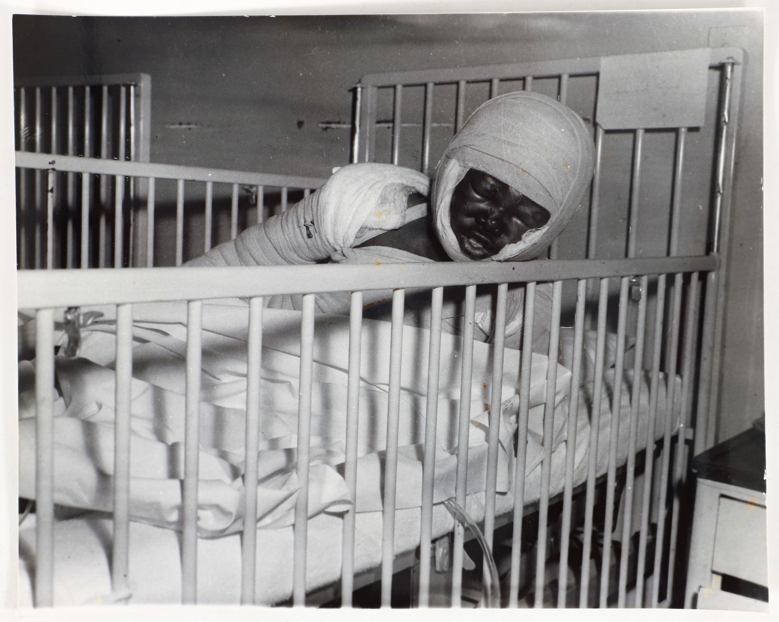Teenie Harris 1959 photo Eleven-year-old Willie Fletcher burn victim (1 of 1)