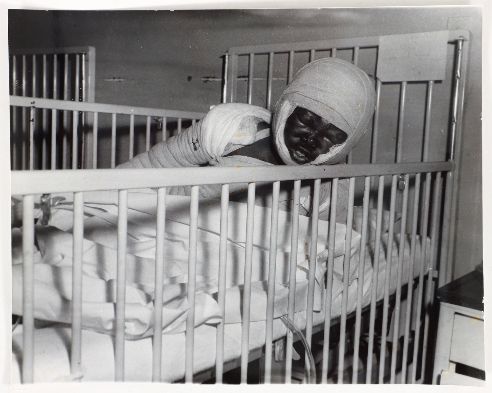Teenie Harris 1959 Photograph Willie Fletcher Burn Victim (1 of 1)