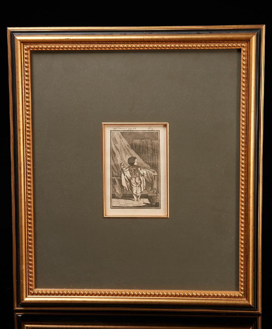 Continental School, diseased child engraving: Continental School, diseased child engraving, Continental School (19th c.), Child with skin disease, engraved plate, inscribed in plate "Supl. Tom, II.P.I. pag 158, Pl.4", 4.75"h x 3"w (image), 17.75"