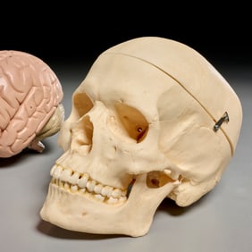 Somso anatomical skull and brain models