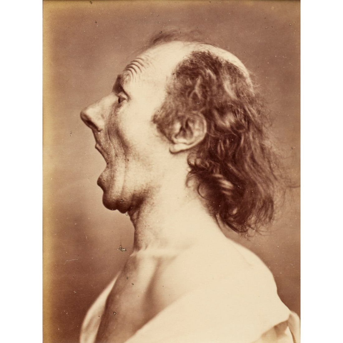 Duchenne de Boulogne, albumen print, ex Sotheby's: Duchenne de Boulogne, albumen print, ex Sotheby's, Guillaume-Benjamin-Amant Duchenne de Boulogne (French, 1806-1875), with Adrien Tournachon (French, 1825?1903), "Astonishment Badly Rendered by the Su