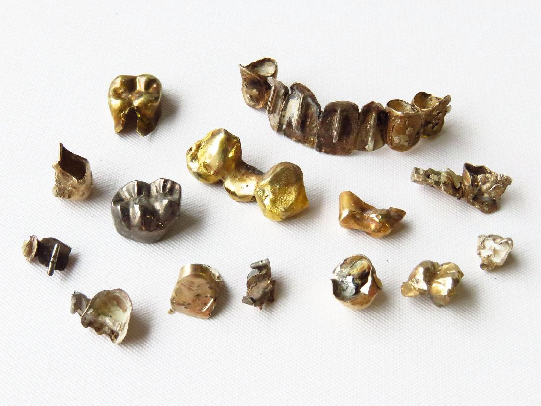 LOT DENTAL GOLD FINDINGS 16K GOLD (1 of 2)