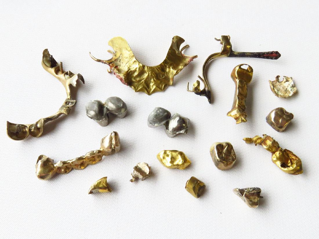 LOT ASSORTED 16K DENTAL GOLD FINDINGS; 61.7 GR. (1 of 2)