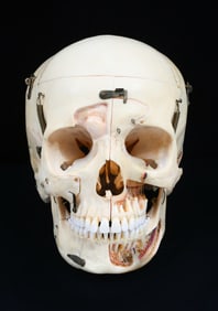 KILGORE INTERNATIONAL BONE MEDICAL SKULL