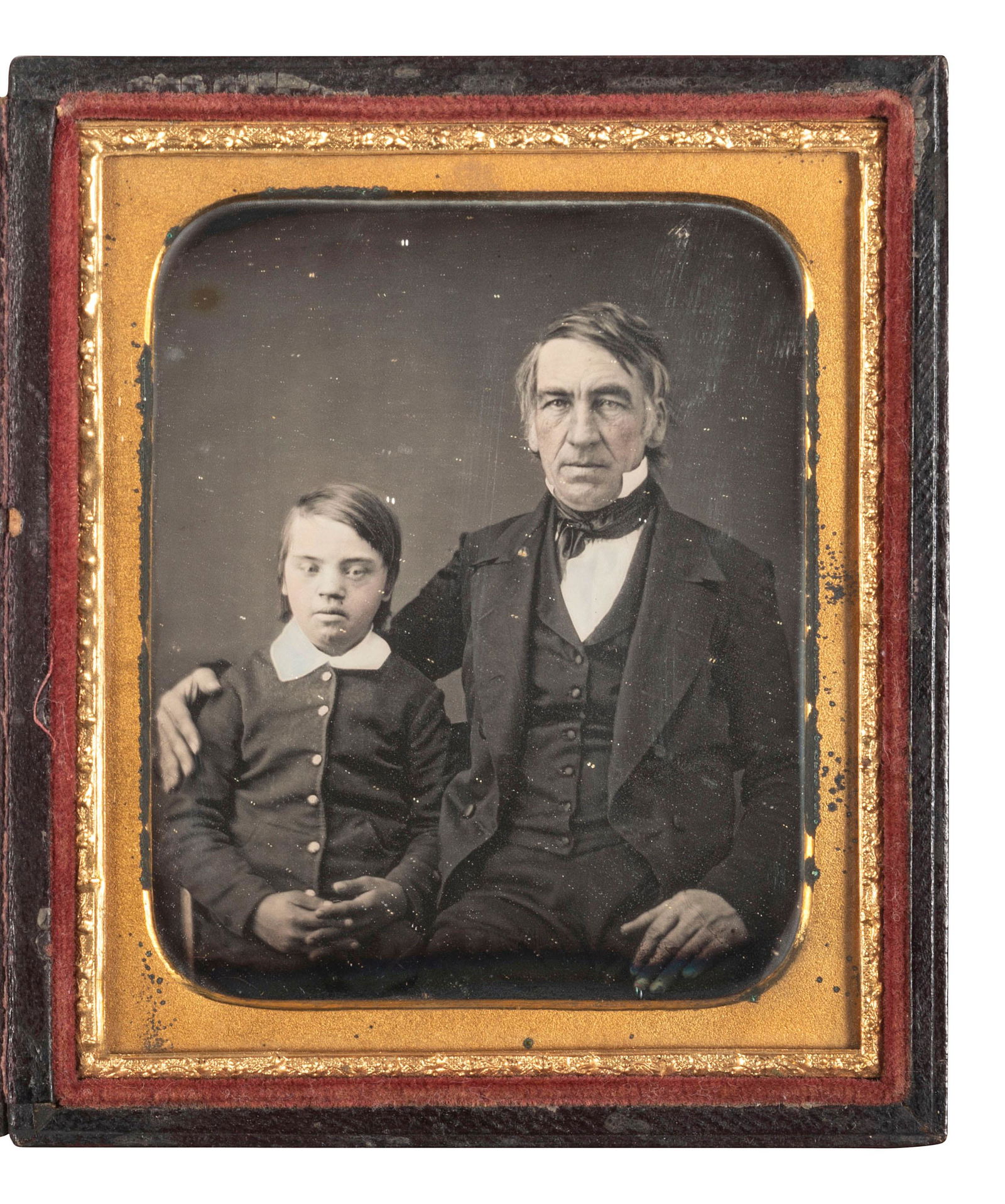 [EARLY PHOTOGRAPHY]. Sixth plate daguerreotype featuring a young boy with Down syndrome.  (1 of 2)