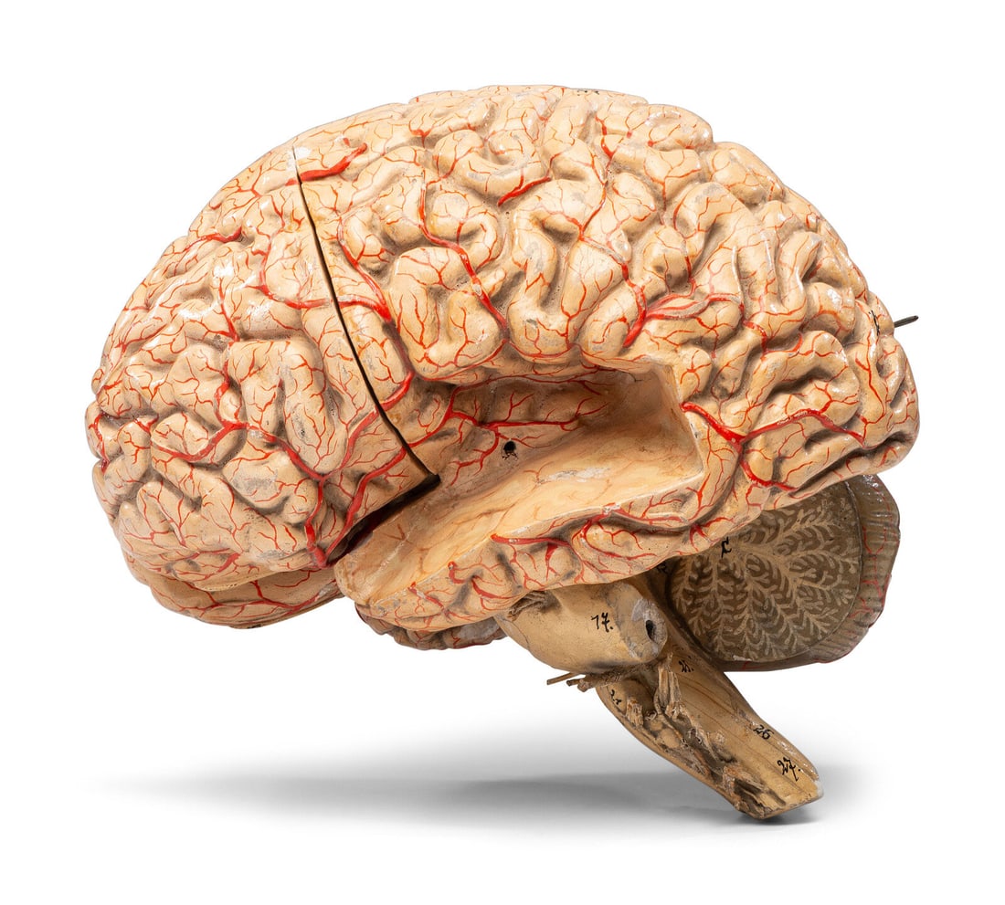 A Painted Plaster Brain Section Model (1 of 7)