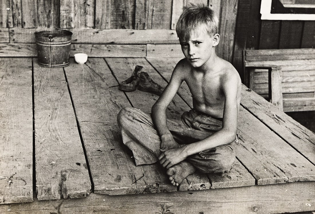 ARTHUR ROTHSTEIN (1915-1985) Son of a Sharecropper, Mississippi County, Arkansas * Sharecropper's: ARTHUR ROTHSTEIN (1915-1985) Son of a Sharecropper, Mississippi County, Arkansas * Sharecropper's child suffering from rickets and malnutrition, Wilson cotton plantation, Mississippi County, Arkansas.