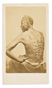 (SLAVERY.) [McPherson & Oliver; photographers.] [The Scourged Back.]