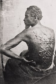 The Scourged Back by McPherson & Oliver. Circa 1863; printed 1970s.