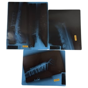 Dan Haggerty - X-Ray Film Dated February 2012