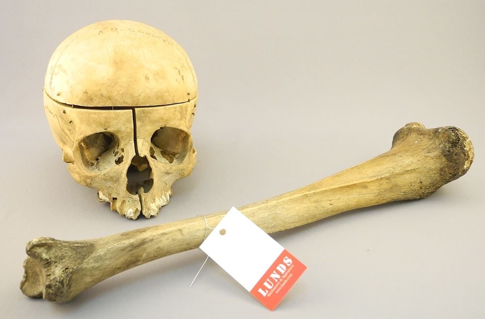 Medical Specimen Skull & Femur, 15 1/4"L. NO EXPORT (1 of 2)
