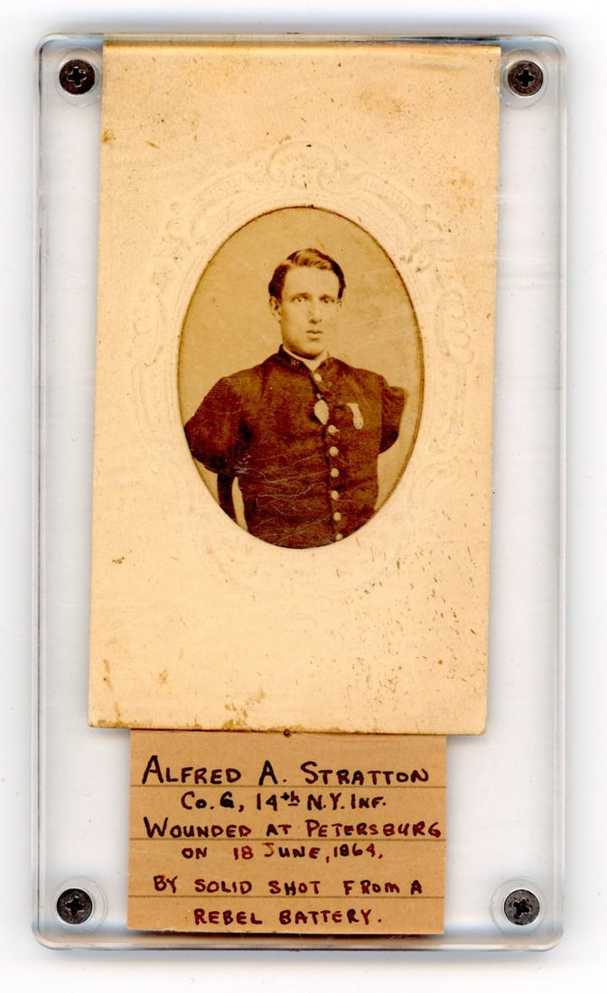 Civil War CDV Alfred Stratton Double Amputee (1 of 1)