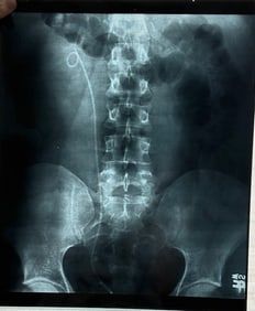 Marilyn Monroe XRAY