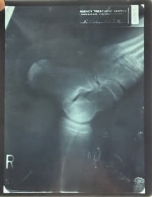 Pete Rose XRAY