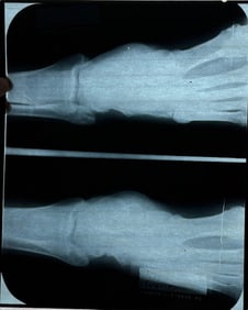 Elvis Presley XRAY