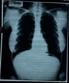 Marilyn Monroe XRAY B