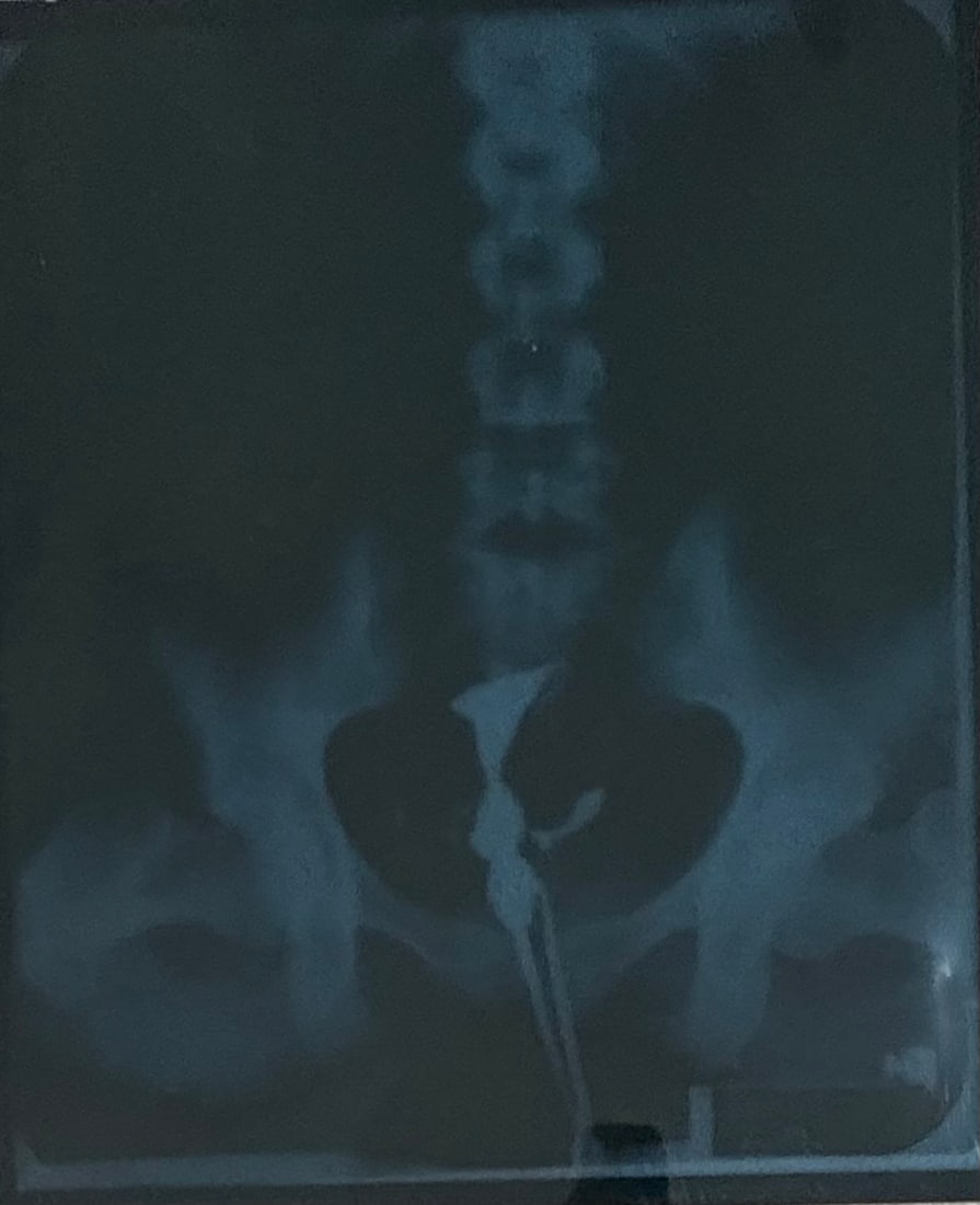 Marilyn Monroe original Xray of pelvic region (1 of 1)