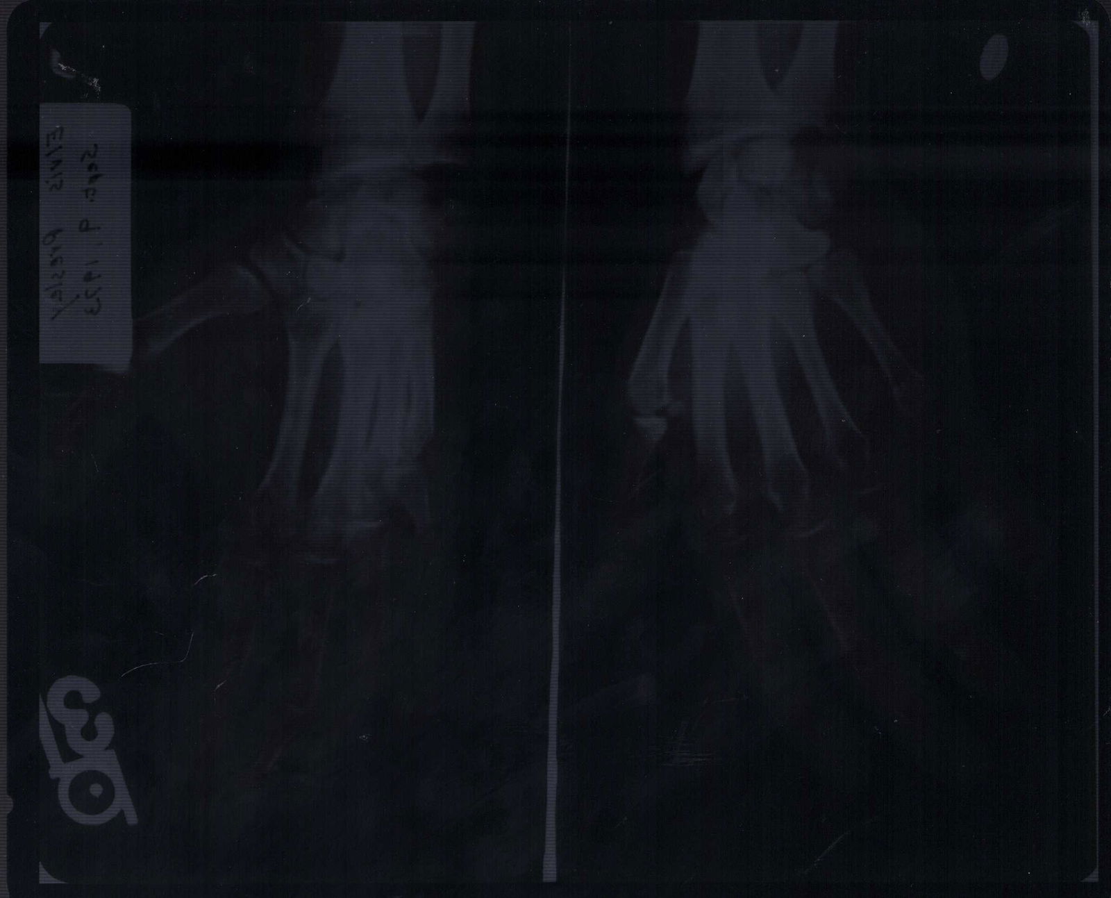 Elvis Presley XRAY (1 of 1)