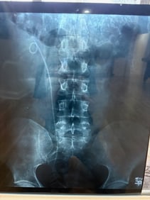 Marilyn Monroe personal Xray made when she was trying to get pregnant