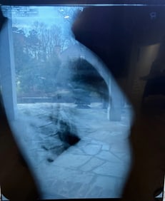 Marilyn Monroe personal Xray made when she was trying to get pregnant B