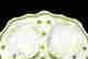 item-93635520=3