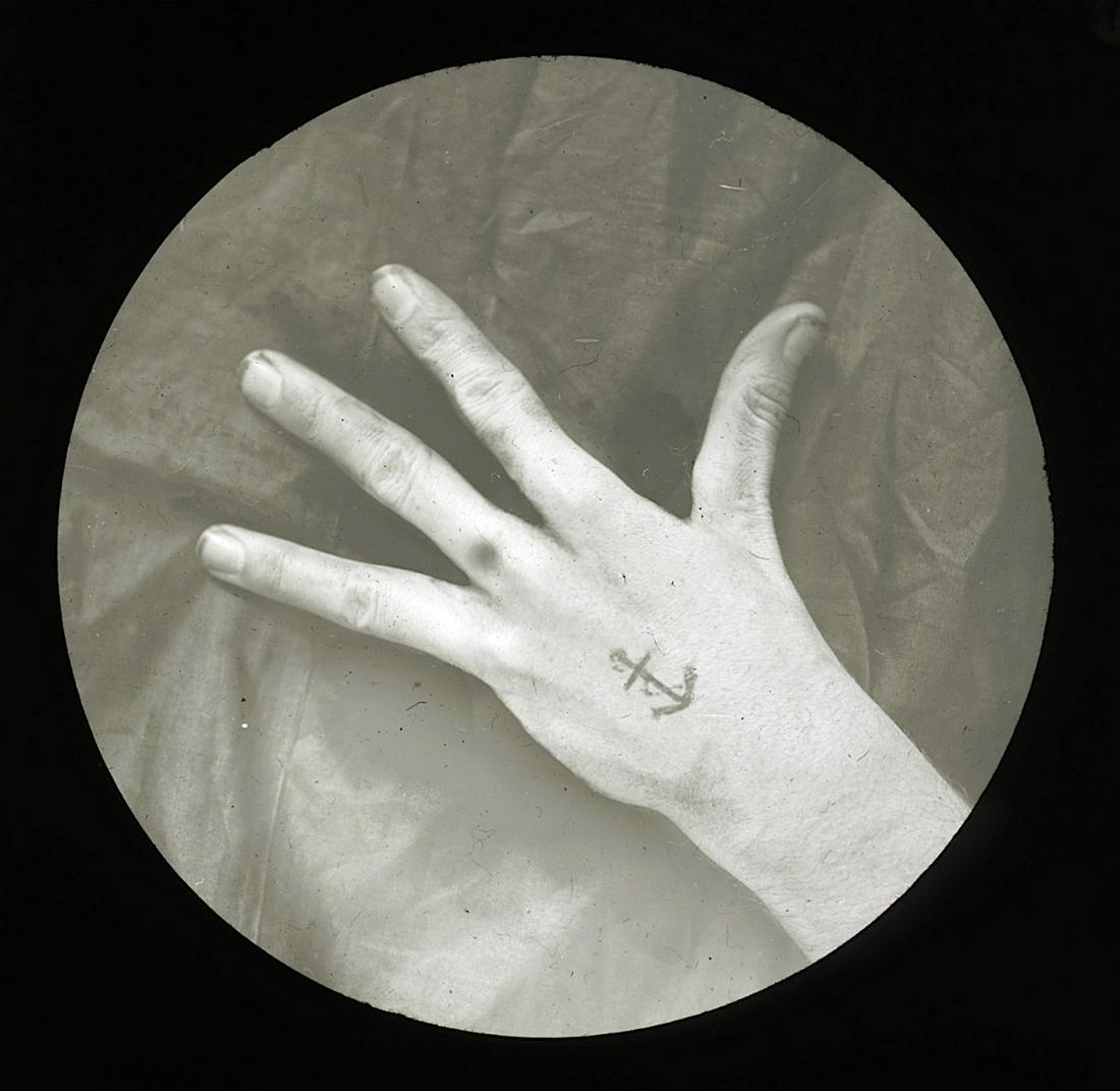 Rare Lantern Glass Photograph Hand 4 Fingers, 19th C. (1 of 2)