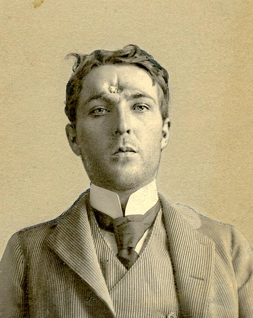 Antique Original Photograph Portrait Bullet Mark (1 of 3)