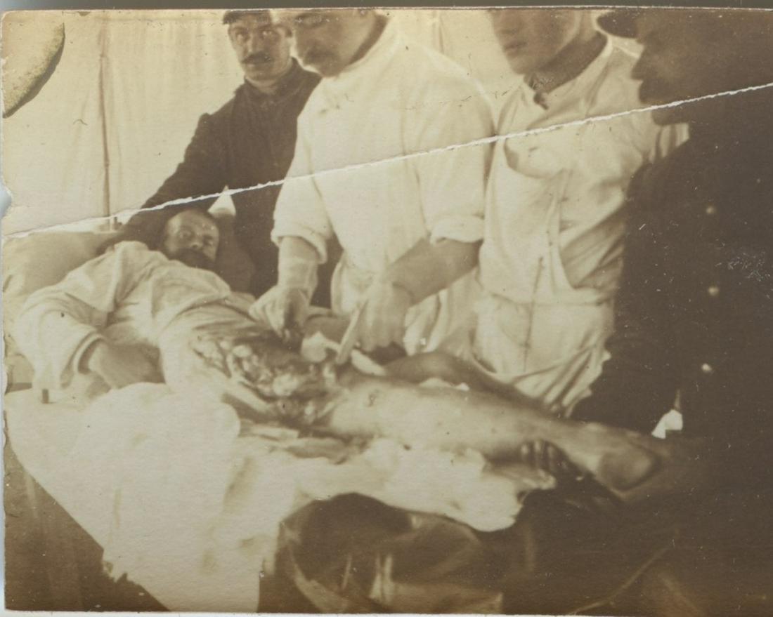Authentic Archive French Surgical Photograph WWI (1 of 2)