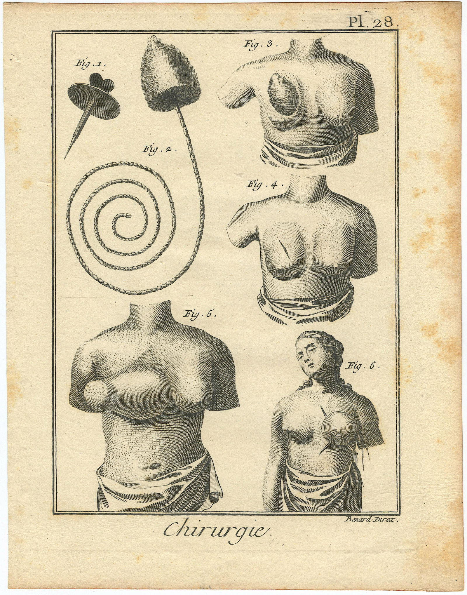 Very Rare Authentic Antique Anatomical Print 18th C. (1 of 1)