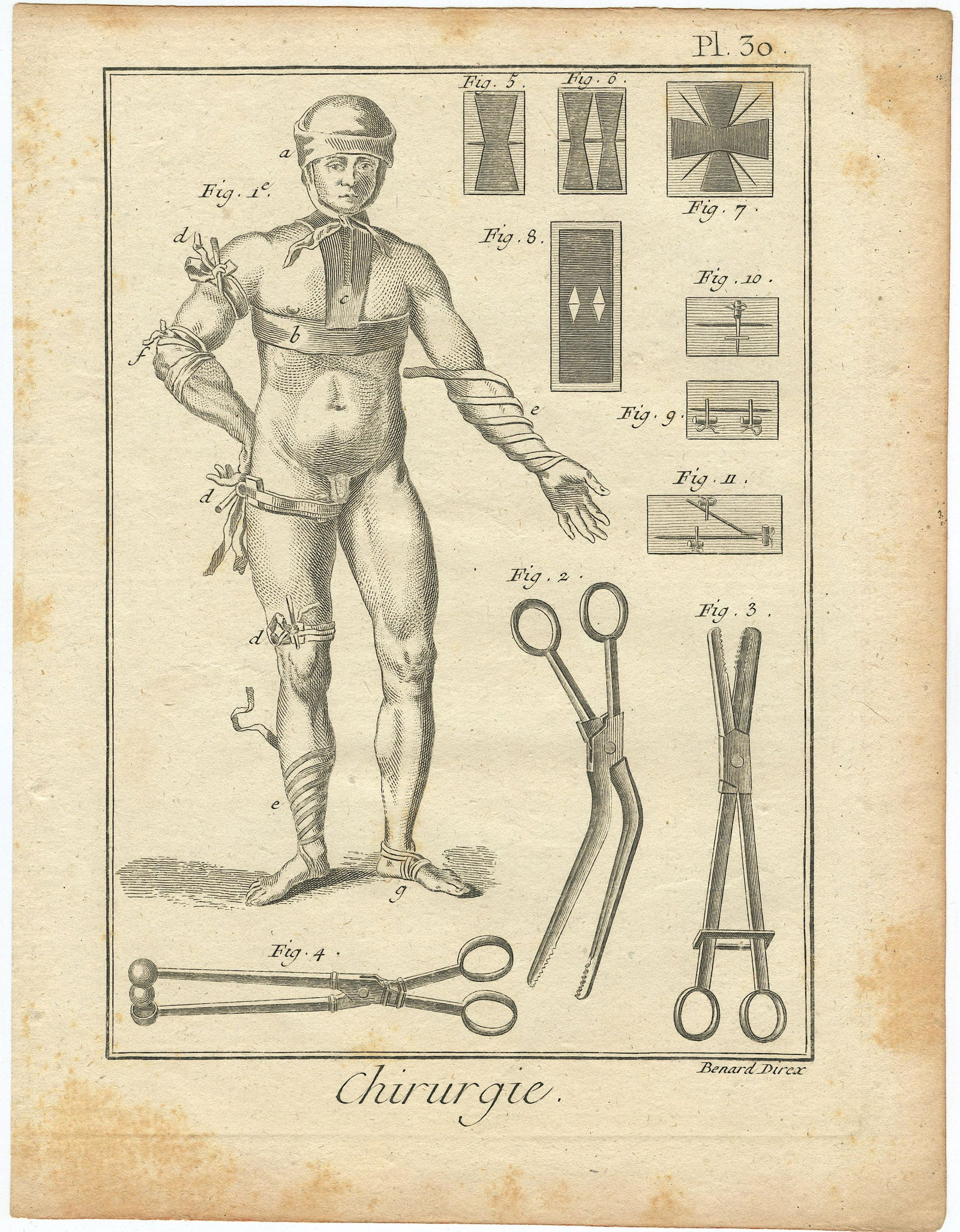 Very Rare Authentic Antique Anatomical Print 18th C. (1 of 1)