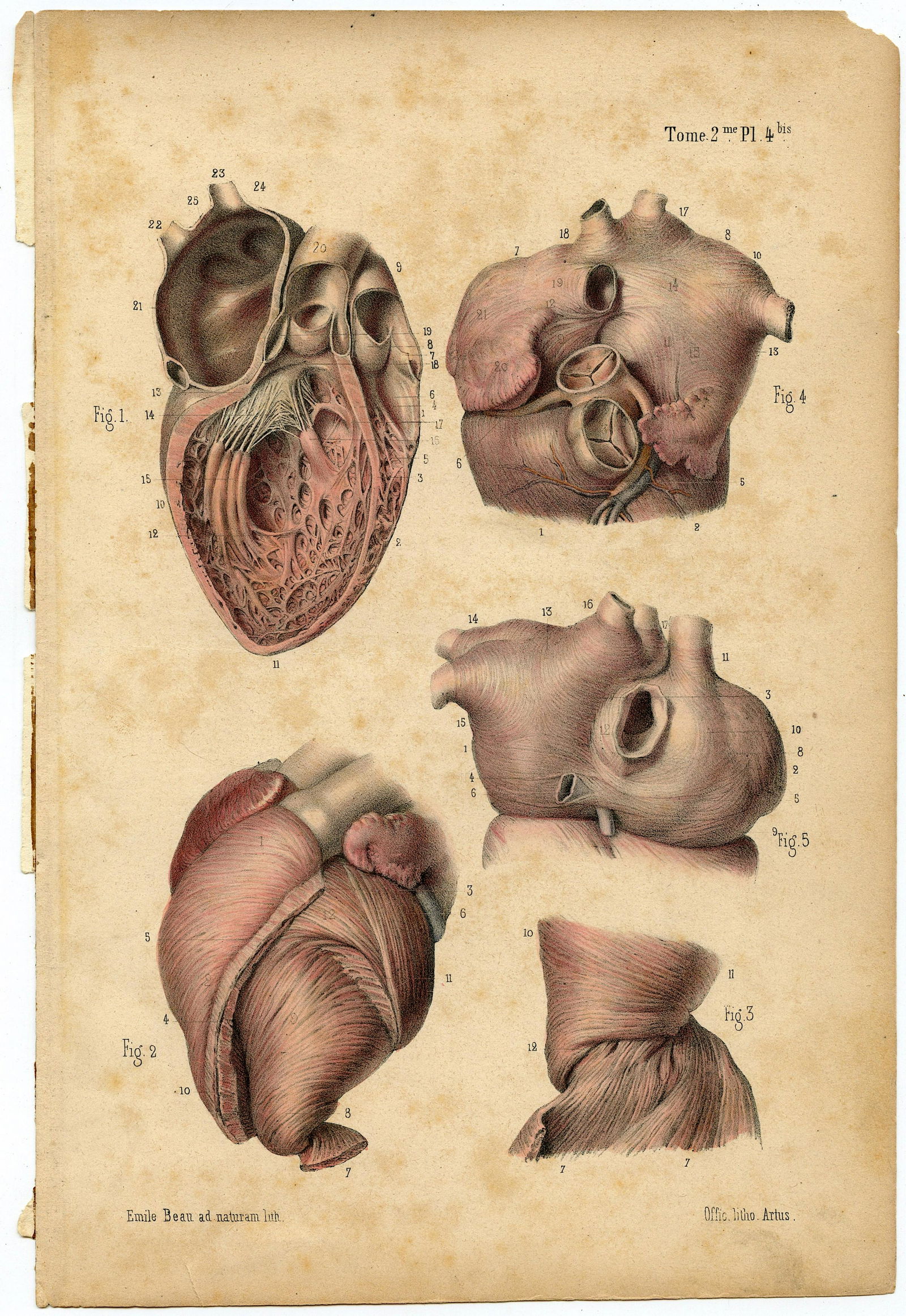 Rare Antique Anatomical Colored Print 19th. C. (1 of 1)