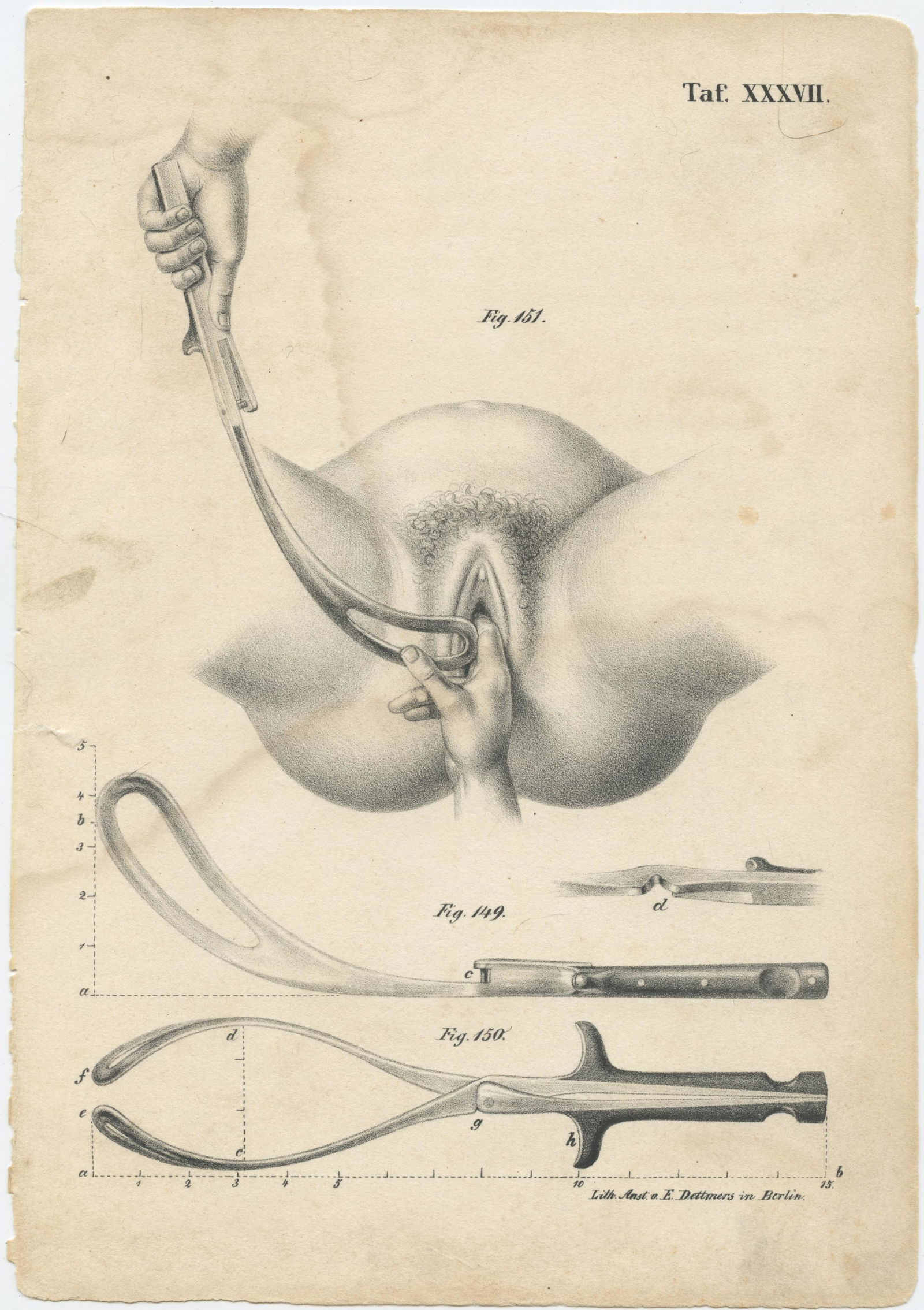 Rare Antique Anatomical Lith. Print 19th. C. (1 of 1)