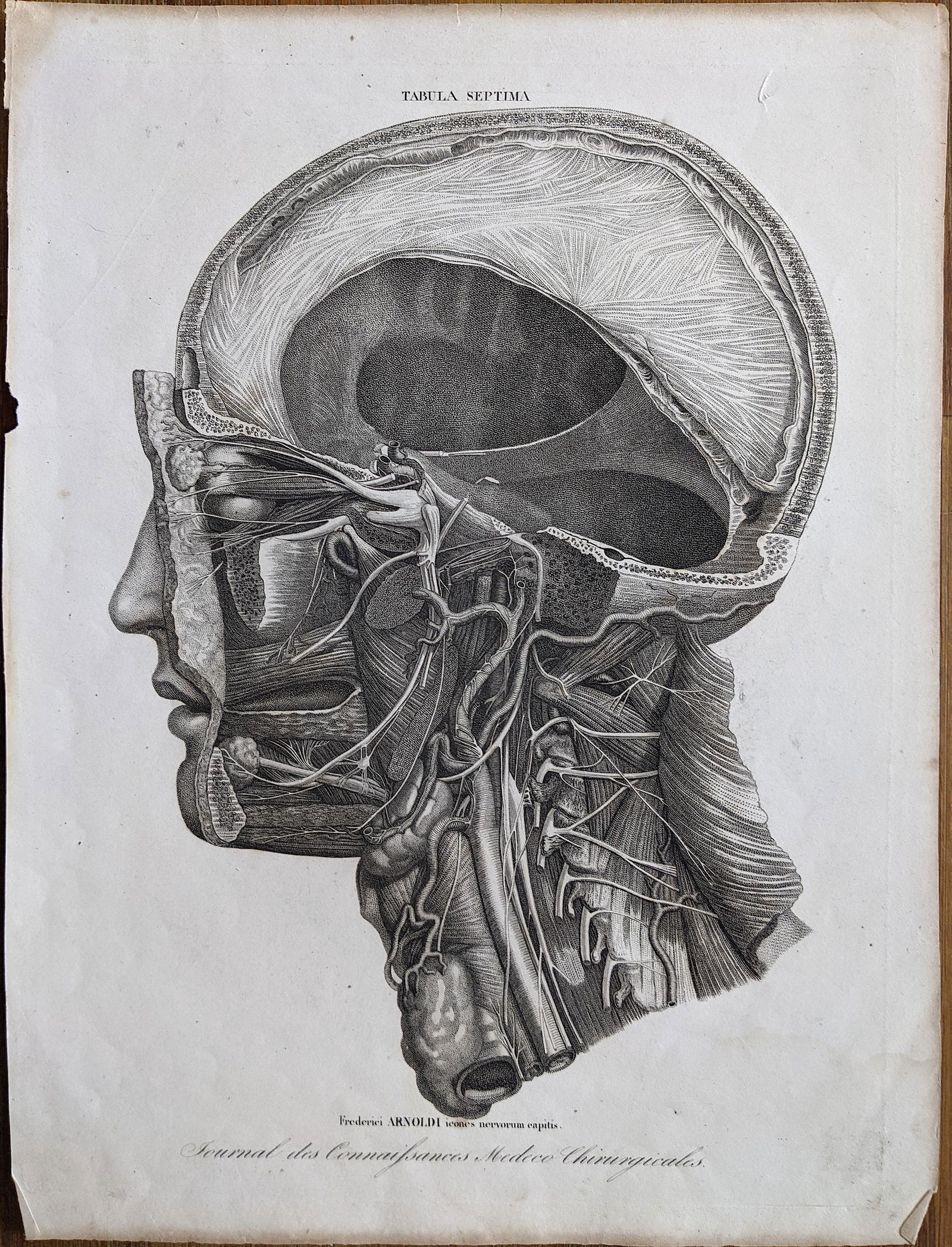 Rare Antique Anatomical Lith. Print 19th C. (1 of 2)