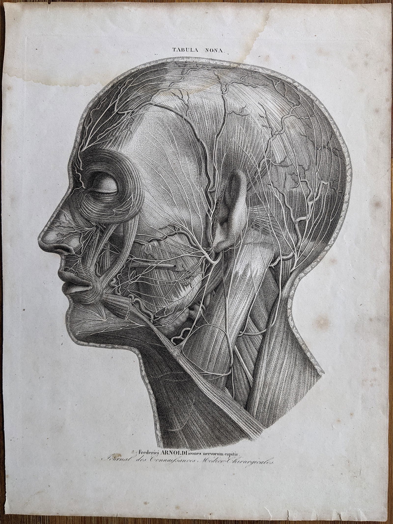 Rare Antique Anatomical Lith. Print 19th C. (1 of 2)