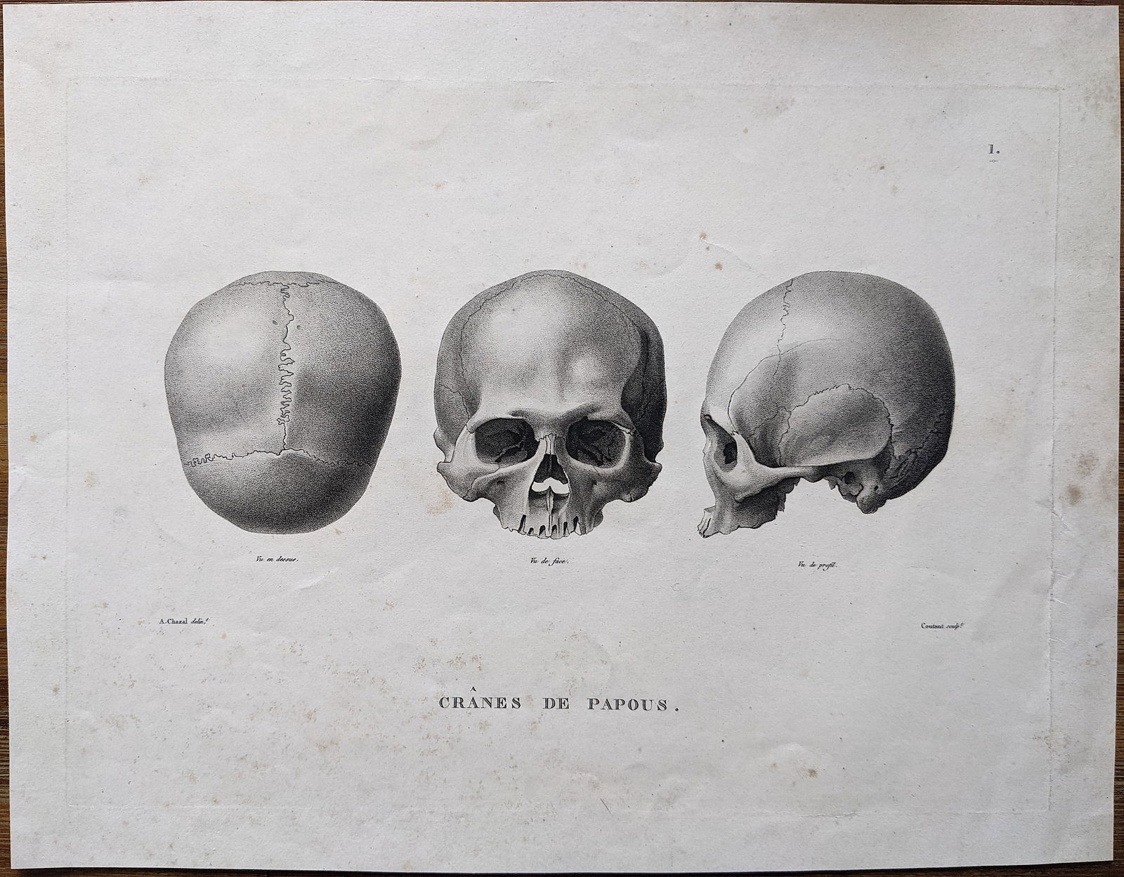 Rare Antique Anatomical Lith. Print 19th C. (1 of 1)