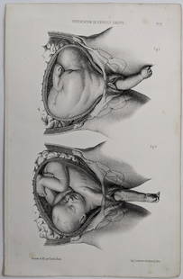 Scarce Antique Medical Litho. Print, 19th C.: This print is from the estate of a collector in New Orleans. The print is authentic antique from the epoch, anatomy diagram by Lemercier, Paris, France, printed in 19th. C..The paper dimensions are