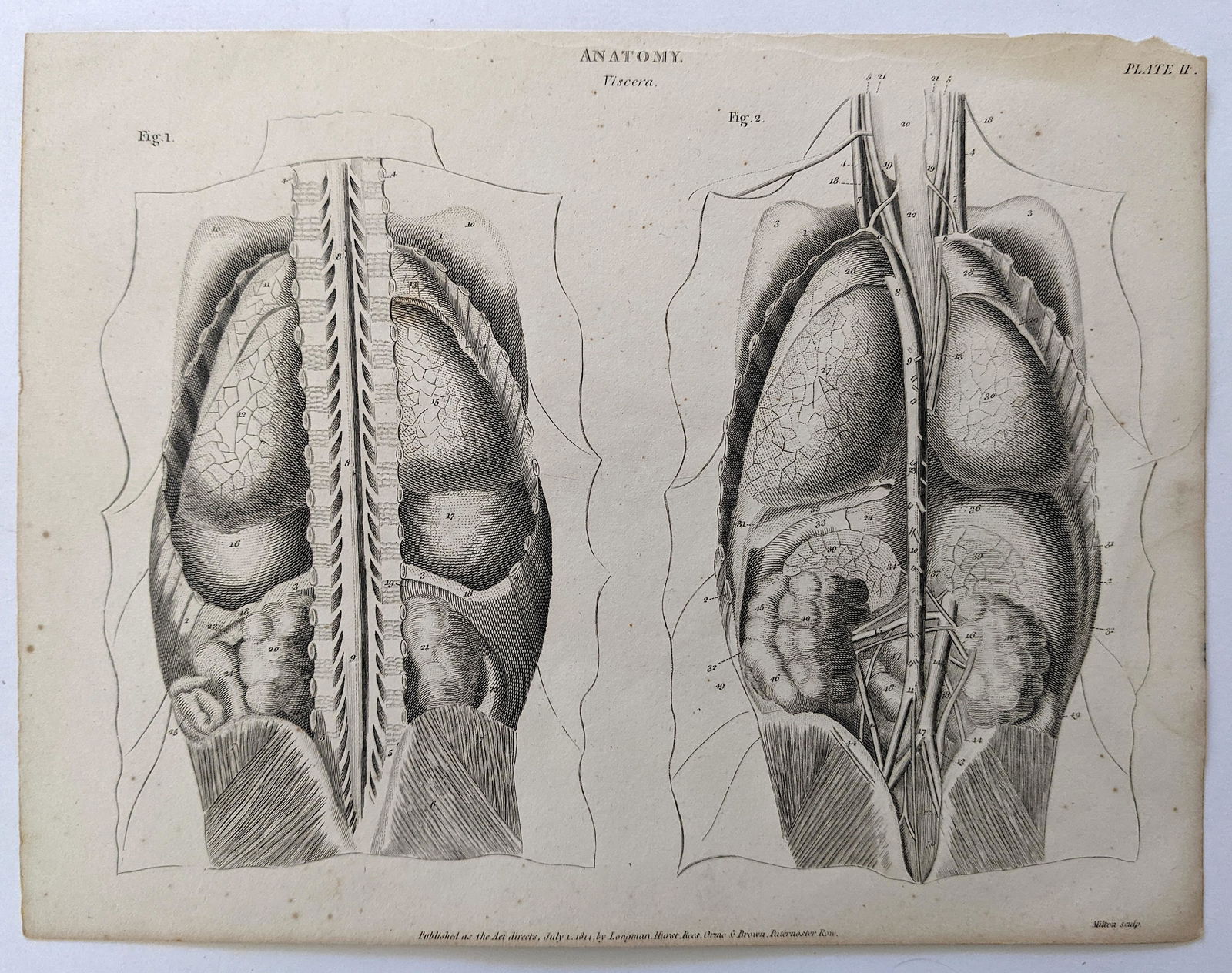 Very Rare Antique Medical Anatomy Etching Print 18th C. (1 of 3)