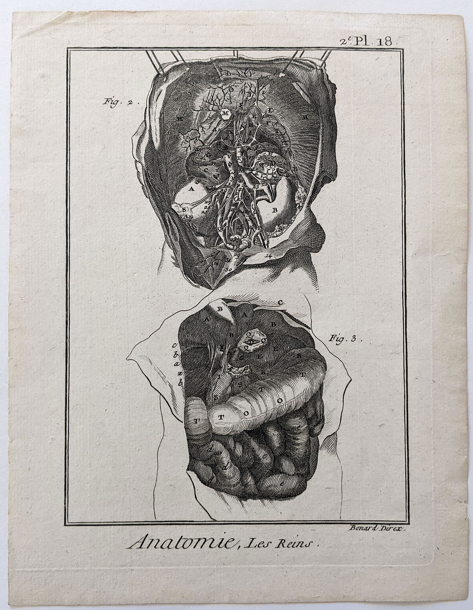 Very Rare Antique Medical Anatomy Etching Print 18th C. (1 of 2)