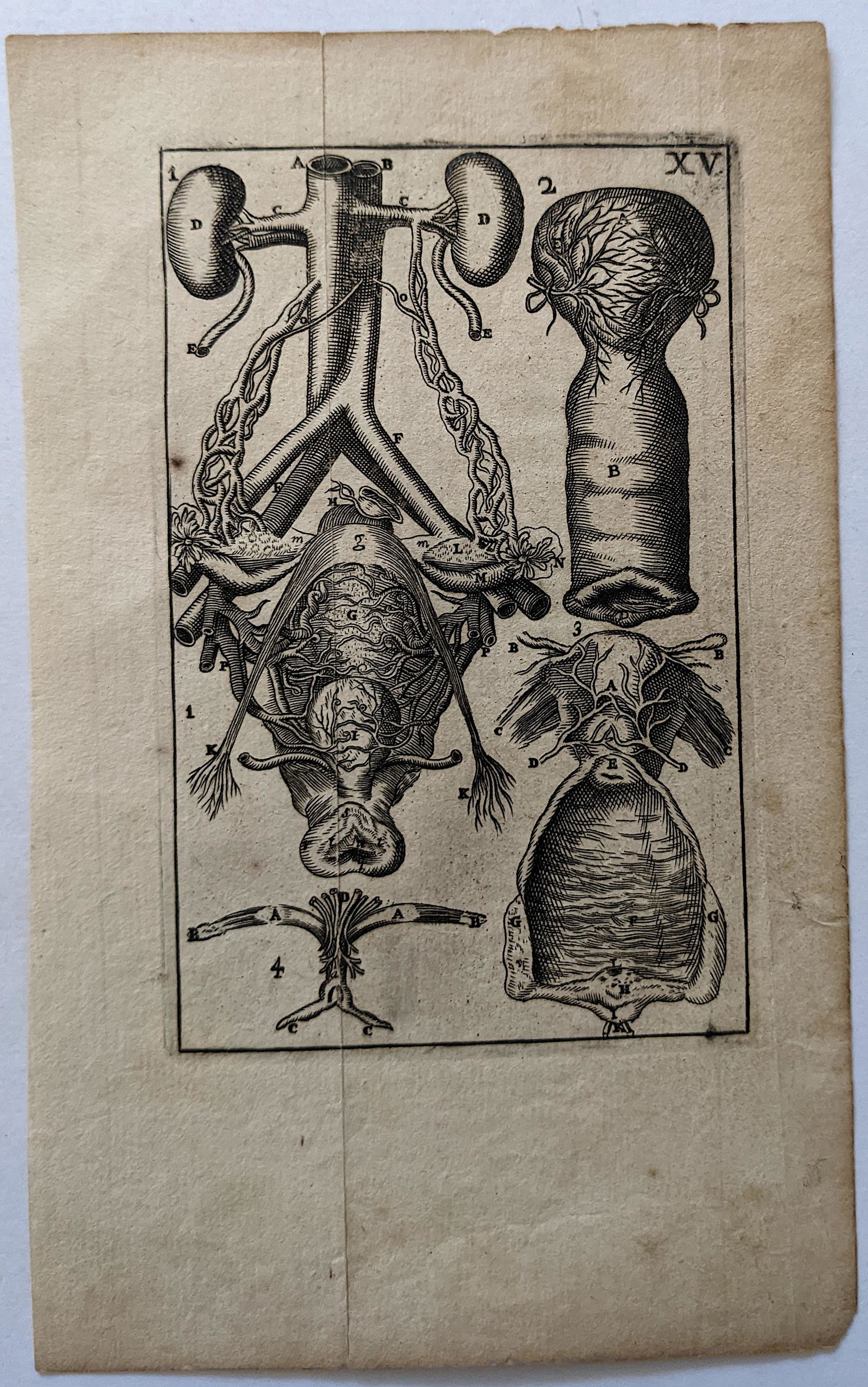 Very Rare Antique Medical Anatomy Etching Print 18th C. (1 of 1)
