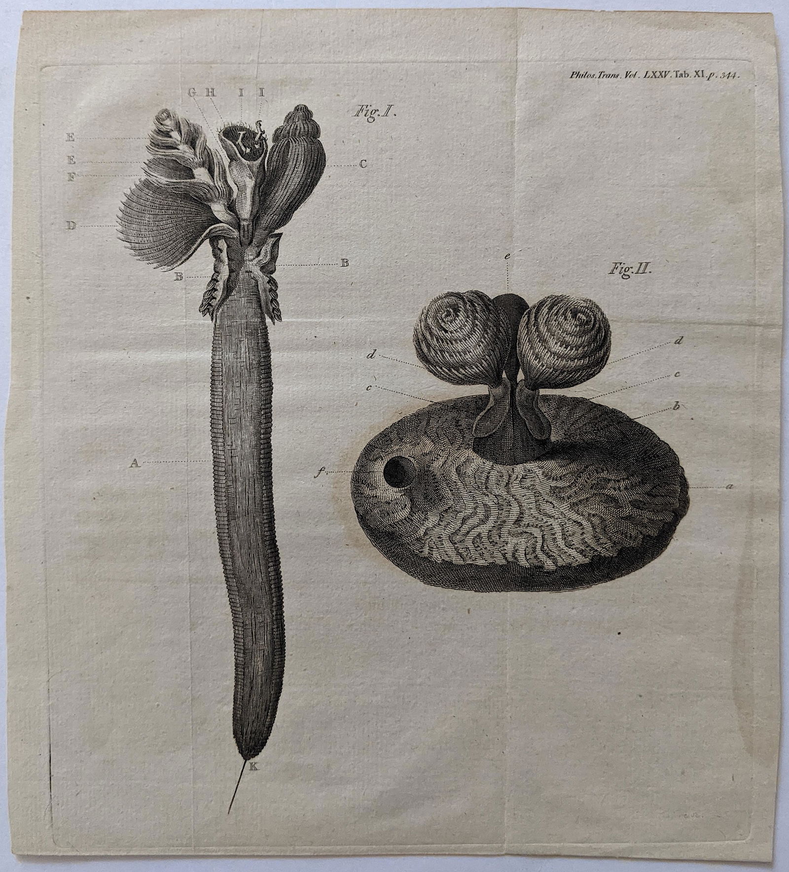 Very Rare Antique Medical Anatomy Etching Print 18th C. (1 of 2)