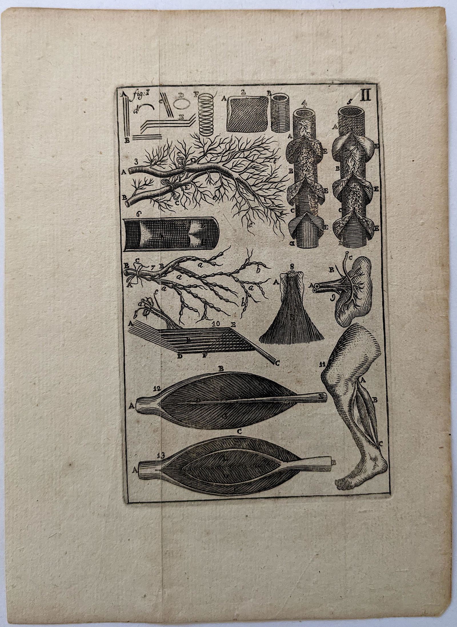 Very Rare Antique Medical Anatomy Etching Print 18th C. (1 of 1)