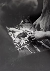 Original Photography by HERB FLATOW  N.Y.Serie Surgeon